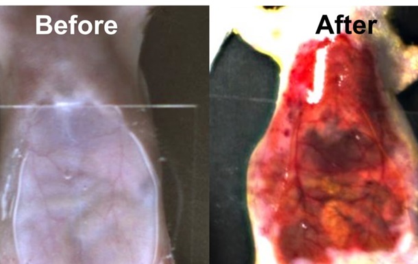 Вчені знайшли спосіб зробити шкіру та м язи прозорими